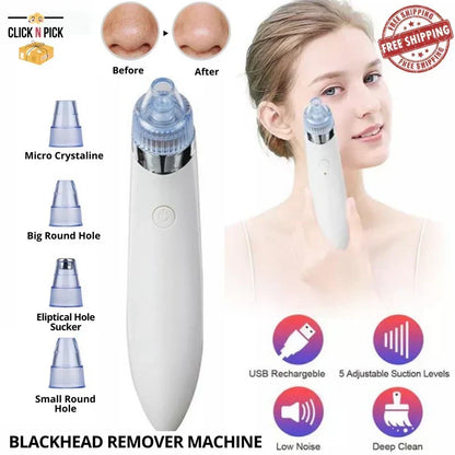 Derma Suction Blackheads Remover Device